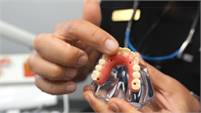  Gardena  Dental Implants